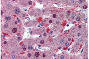 Human Liver: Formalin-Fixed, Paraffin-Embedded (FFPE) (CELF1 antibody  (AA 120-169))