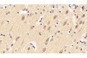 Detection of NRN1 in Porcine Cerebrum Tissue using Polyclonal Antibody to Neuritin 1 (NRN1) (NRN1 antibody  (AA 28-142))