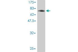 Western Blot detection against Immunogen (75. (PIGO antibody  (AA 1-454))