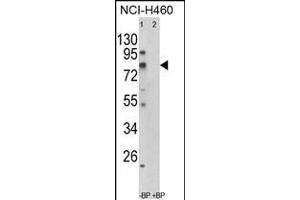 Western blot analysis of ACSS3 Antibody in NCI-H460 cell line lysates (35ug/lane)(2ug/ml) (ACSS3 antibody  (AA 224-251))