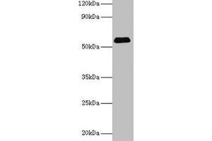 Western blot All lanes: SUOX antibody at 2 μg/mL + Rat liver tissue Secondary Goat polyclonal to rabbit IgG at 1/15000 dilution Predicted band size: 61 kDa Observed band size: 61 kDa (SUOX antibody  (AA 80-545))