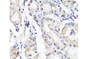 Immunohistochemistry of paraffin-embedded Human stomach using TBX20 Polyclonal Antibody at dilution of 1:100 (40x lens). (TBX20 antibody)