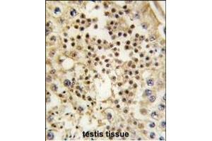 Formalin-fixed and paraffin-embedded human testis tissue reacted with LIN28A Monoclonal Antibody (ABIN387790 and ABIN2838026) , which was peroxidase-conjugated to the secondary antibody, followed by DAB staining. (LIN28A antibody)
