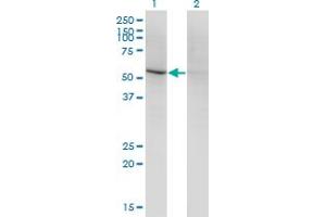 Western Blot analysis of CD84 expression in transfected 293T cell line by CD84 monoclonal antibody (M01), clone 3G10. (CD84 antibody  (AA 22-121))