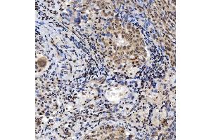 IHC analysis of SNRNP200 using anti-SNRNP200 antibody (ABIN7602032). (SNRNP200 antibody  (AA 557-2129))