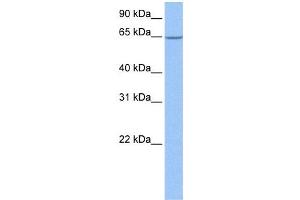 Western Blot showing NOL5A antibody used at a concentration of 1-2 ug/ml to detect its target protein. (NOP56 antibody)