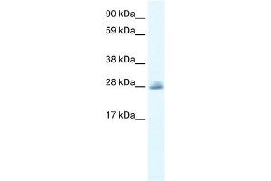 CLIC5 antibody used at 0. (CLIC5 antibody  (C-Term))