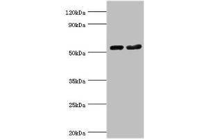 Western blot All lanes: Septin-7 antibody at 9 μg/mL Lane 1: Hela whole cell lysate Lane 2: Mouse gonad tissue Secondary Goat polyclonal to rabbit IgG at 1/10000 dilution Predicted band size: 51 kDa Observed band size: 51 kDa (Septin 7 antibody  (AA 308-437))