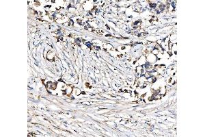 IHC analysis of CPT1A using anti-CPT1A antibody (ABIN7599853).