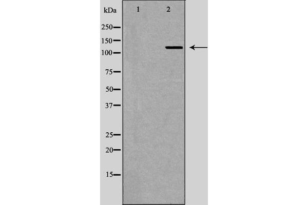 RENT1/UPF1 antibody