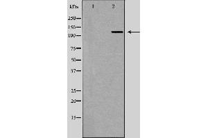 Western blot analysis of Hela whole cell lysates, using UPF1  Antibody. (RENT1/UPF1 antibody)