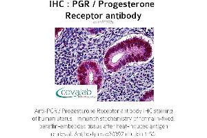 Image no. 1 for anti-Progesterone Receptor (PGR) antibody (ABIN1722411) (Progesterone Receptor antibody)