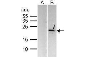 WB Image Western Blot analysis of MKP-6 expression in transfected 293T cell line (20ug of whole cell ltsate) A: Non-transfected lysate. (DUSP14 antibody  (C-Term))