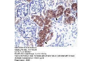 Rabbit Anti-SOX18 Antibody  Paraffin Embedded Tissue: Human Kidney Cellular Data: Epithelial cells of renal tubule Antibody Concentration: 4. (SOX18 antibody  (Middle Region))