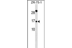 TI Antibody (Center) (ABIN6242753 and ABIN6577350) western blot analysis in ZR-75-1 cell line lysates (35 μg/lane). (TIMM9 antibody  (AA 18-44))
