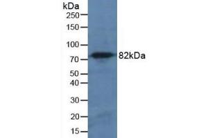 Detection of CAPN1 in Mouse Pancreas Tissue using Polyclonal Antibody to Calpain 1 (CAPN1) (CAPN1 antibody  (AA 75-343))