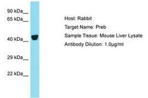 Image no. 1 for anti-Prolactin Regulatory Element Binding (PREB) (N-Term) antibody (ABIN6750398) (PREB antibody  (N-Term))