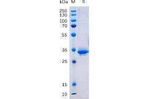 Human TM4SF1 Protein, hFc Tag on SDS-PAGE under reducing condition.
