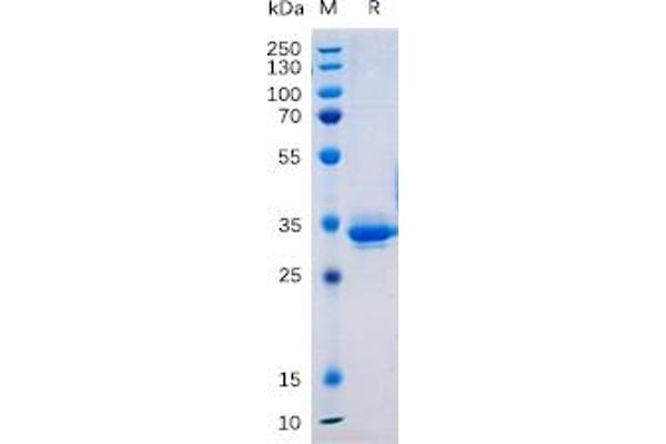 TM4SF1 Protein (Fc Tag)