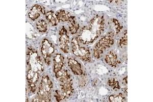 Immunohistochemical staining of human kidney with ESPN polyclonal antibody  shows strong membranous and weak nuclear positivity in tubular cells.