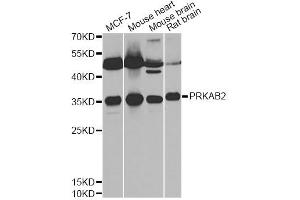 Western blot analysis of extracts of various cell lines, using PRKAB2 antibody (ABIN6291758) at 1:1000 dilution.