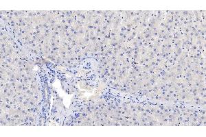 Detection of NOS2 in Human Liver Tissue using Monoclonal Antibody to Nitric Oxide Synthase 2, Inducible (NOS2) (NOS2 antibody  (AA 533-696))