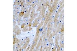 Immunohistochemical analysis of OGT staining in rat heart formalin fixed paraffin embedded tissue section. (OGT antibody)