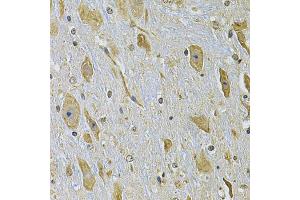 Immunohistochemistry of paraffin-embedded mouse brain using ITGA2 Antibody (ABIN2563445) at dilution of 1:100 (40x lens). (ITGA2 antibody)