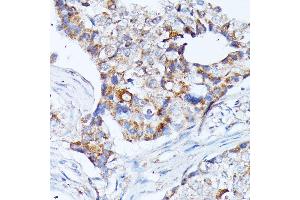 Immunohistochemistry (IHC) image for anti-Potassium Inwardly-Rectifying Channel, Subfamily J, Member 15 (KCNJ15) (AA 221-375) antibody (ABIN7269475)
