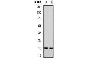Western blot analysis of STMN1 expression in Hela (A), COS7 (B) whole cell lysates. (Stathmin 1 antibody  (N-Term))