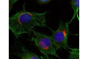 Immunocytochemistry (ICC) image for anti-RAB6A, Member RAS Oncogene Family (RAB6A) (AA 1-205) antibody (ABIN1742534) (RAB6A antibody  (AA 1-205))