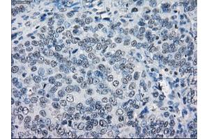 Immunohistochemical staining of paraffin-embedded colon tissue using anti-LTA4Hmouse monoclonal antibody. (LTA4H antibody)