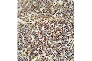 Immunohistochemistry analysis in human lymph node (formalin-fixed, paraffin-embedded) using LAPTM5  Antibody  (N-term), followed by peroxidase conjugation of the secondary antibody and DAB staining. (LAPTM5 antibody  (N-Term))