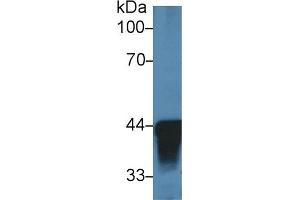 Detection of ADH1 in Human Liver lysate using Polyclonal Antibody to Alcohol Dehydrogenase 1 (ADH1) (ADH1 antibody  (AA 25-228))