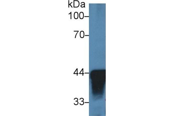 ADH1 anticorps  (AA 25-228)