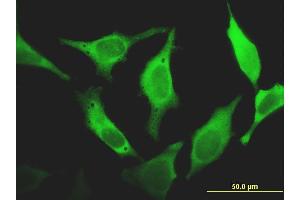 Immunofluorescence of monoclonal antibody to FHIT on HeLa cell. (FHIT antibody  (AA 31-130))