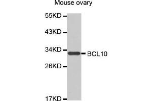 Western Blotting (WB) image for anti-B-Cell CLL/lymphoma 10 (BCL10) antibody (ABIN1678837) (BCL10 antibody)