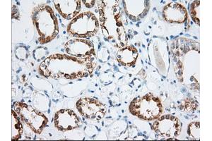 Immunohistochemical staining of paraffin-embedded Human Kidney tissue using anti-MIOX mouse monoclonal antibody. (MIOX antibody)