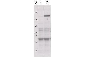 Western blot using  affinity purified anti-ROCK-2 pY256 antibody shows detection of phosphorylated ROCK-2 in transfected 293T cells. (ROCK2 antibody  (pTyr256))