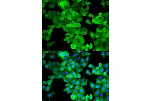 Immunofluorescence (IF) image for anti-Caldesmon 1 (CALD1) antibody (ABIN1876554) (Caldesmon antibody)