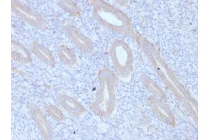 Formalin-fixed, paraffin-embedded human Endometrium stained with ATG5 Mouse Monoclonal Antibody (ATG5/2553). (ATG5 antibody  (AA 1-119))
