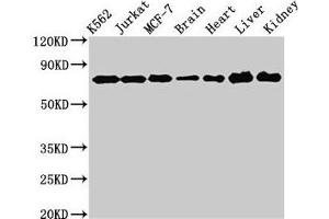 Western Blot Positive WB detected in: K562 whole cell lysate, Jurkat whole cell lysate, MCF-7 whole cell lysate, Rat brain tissue, Rat heart tissue, Mouse liver tissue, Mouse kidney tissue All lanes: DDX3X antibody at 3 μg/mL Secondary Goat polyclonal to rabbit IgG at 1/50000 dilution Predicted band size: 74, 72 kDa Observed band size: 74 kDa (DDX3X antibody  (AA 2-662))