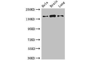 Western Blot Positive WB detected in: Hela whole cell lysate, Mouse brain tissue, Rat lung tissue All lanes: SULF2 antibody at 2. (SULF2 antibody  (AA 463-660))