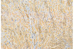 ABIN6261290 and ABIN6272914 at 1/100 staining Rat kidney tissue by IHC-P. (DHRS3 antibody  (Internal Region))