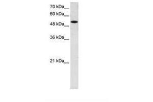 Image no. 1 for anti-Solute Carrier Family 25 (Mitochondrial Carrier, Phosphate Carrier), Member 25 (SLC25A25) (AA 71-120) antibody (ABIN6736655) (SLC25A25 antibody  (AA 71-120))