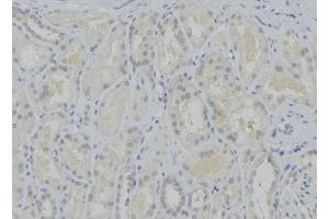ABIN6273751 at 1/100 staining Mouse kidney tissue by IHC-P. (CYP17A1 antibody  (Internal Region))