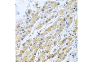 Immunohistochemistry of paraffin-embedded human liver using STC1 antibody at dilution of 1:100 (40x lens).