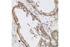 Immunohistochemistry of paraffin-embedded human prostate using CAST antibody (ABIN5970004) at dilution of 1/100 (40x lens). (Calpastatin antibody)