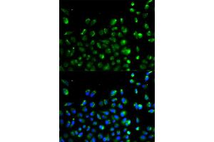 Immunofluorescence analysis of A549 cells using ATG13 antibody. (ATG13 antibody)