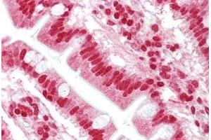 Anti-OAS1 antibody IHC staining of human small intestine. (OAS1 antibody  (AA 324-373))